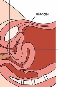 round lady seductively posing in undergarments